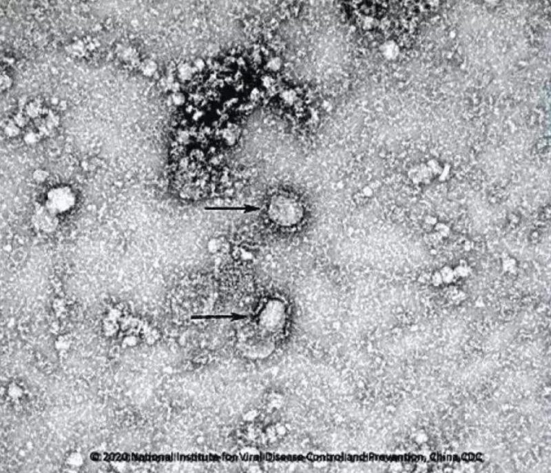 ▲新型冠狀病毒武漢株01。照片來源：國家病原微生物資源庫（中國疾病預(yù)防控制中心病毒病預(yù)防控制所）